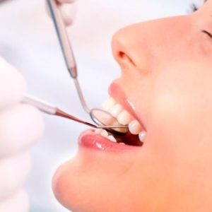 Восстановление эмали зубов
