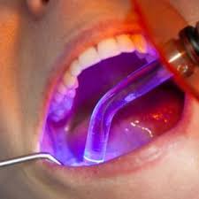 Диагностика и исправление неправильного прикуса зубо